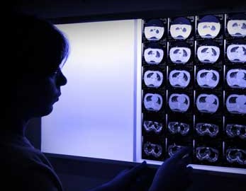 Radiology reviews backlit x-ray scans