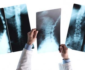 Radiologic technologist reviewing x-rays