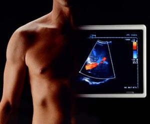 cardio imaging screen in front of torso of male patient