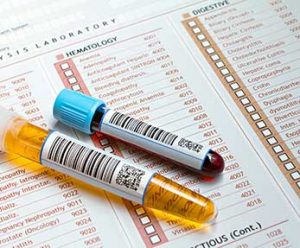 Vials on top of medical form with laboratory analyses and their medical codes