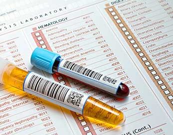 Vials on top of medical form with laboratory analyses and their medical codes